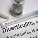 Diverticulitis